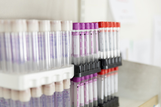 blood sample tubes