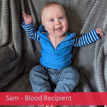 baby Sam after open heart surgery where he got blood transfusions